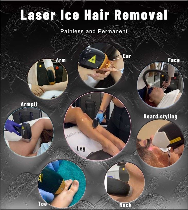 Alma Soprano Ice Titanium Hair Removal Machine
