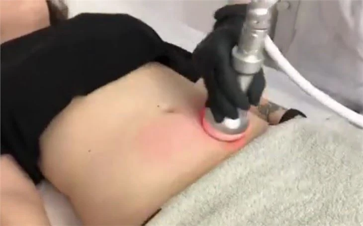 Cryoskin 3.0