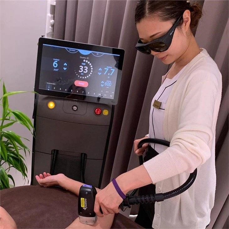 The Most Popular Laser Hair Removal Machine in Beauty Salons