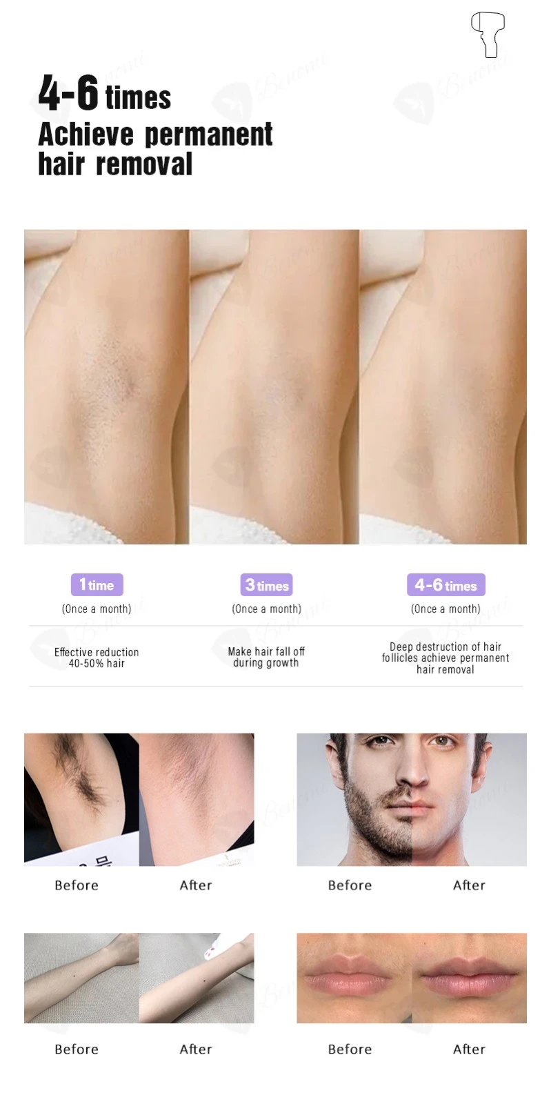 4 Wavelength 3000W Diode Laser Hair Removal Machine – Permanent, Painless, And Professional Solution suppliers