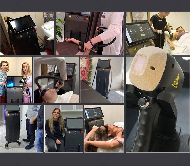 Professional Alma Diode Laser Hair Removal Machine – Advanced, Fast, And Painless