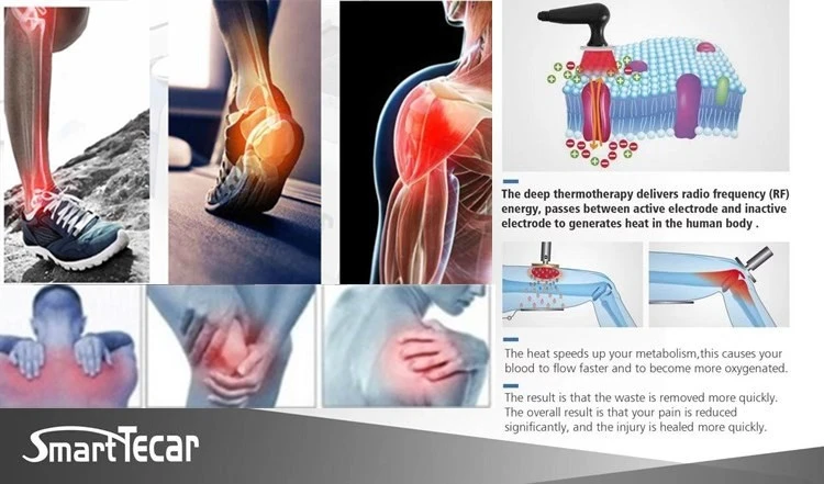Tecar Therapy Machine Price